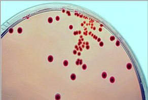 Test de sobrecrecimiento bacteriano